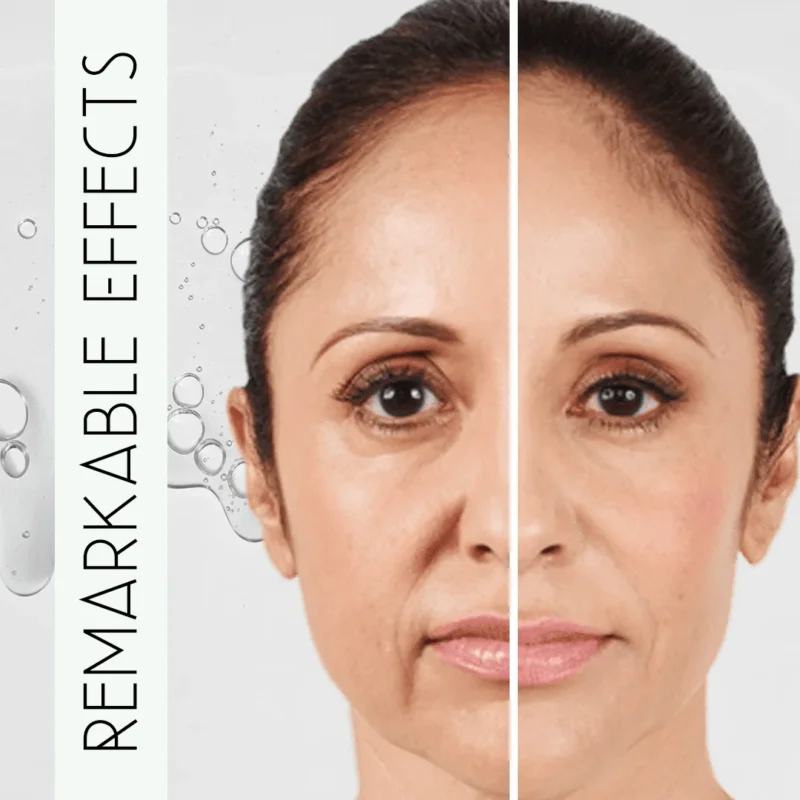 Intense Wrinkle Lift – Multiaction Anti Ageing Formula before after effect